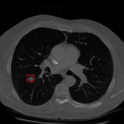 Chest CT synthetic 2D image