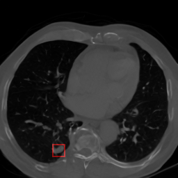 Chest CT synthetic 2D image